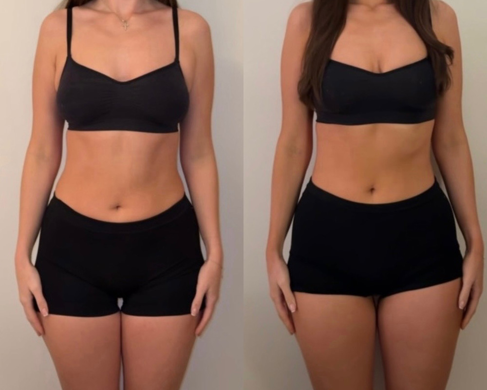 Transformation 5